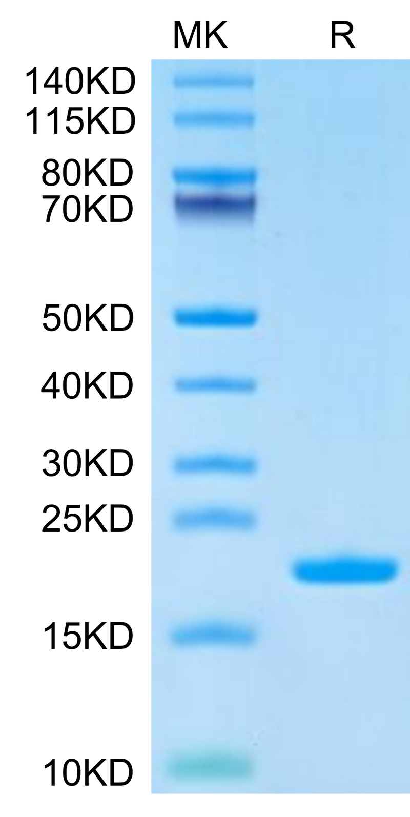 Cynomolgus IL-1 Beta on Tris-Bis PAGE under reduced condition. The purity is greater than 95%.Recombinant Cynomolgus IL-1 Beta/IL-1F2 Protein, Active