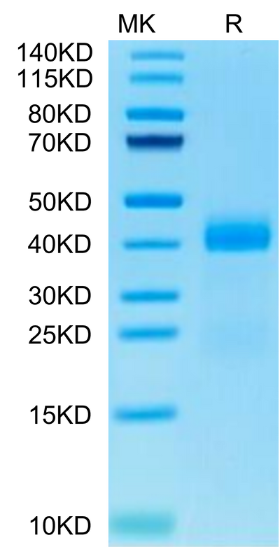 Cynomolgus Galectin 3 on Tris-Bis PAGE under reduced condition. The purity is greater than 95%.Recombinant Cynomolgus Galectin 3 Protein, Active