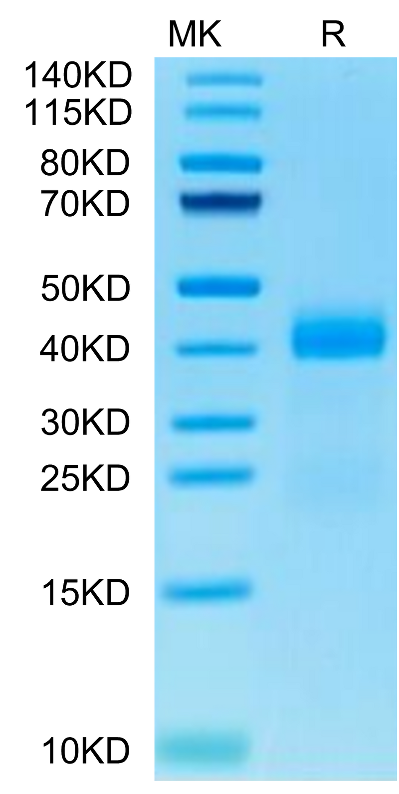 Cynomolgus Galectin 3 on Tris-Bis PAGE under reduced condition. The purity is greater than 95%.Recombinant Cynomolgus Galectin 3 Protein, Active