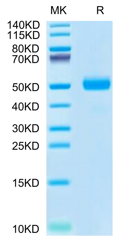 Cynomolgus SPP1 on Tris-Bis PAGE under reduced condition. The purity is greater than 95%.Recombinant Cynomolgus SPP1/OPN Protein
