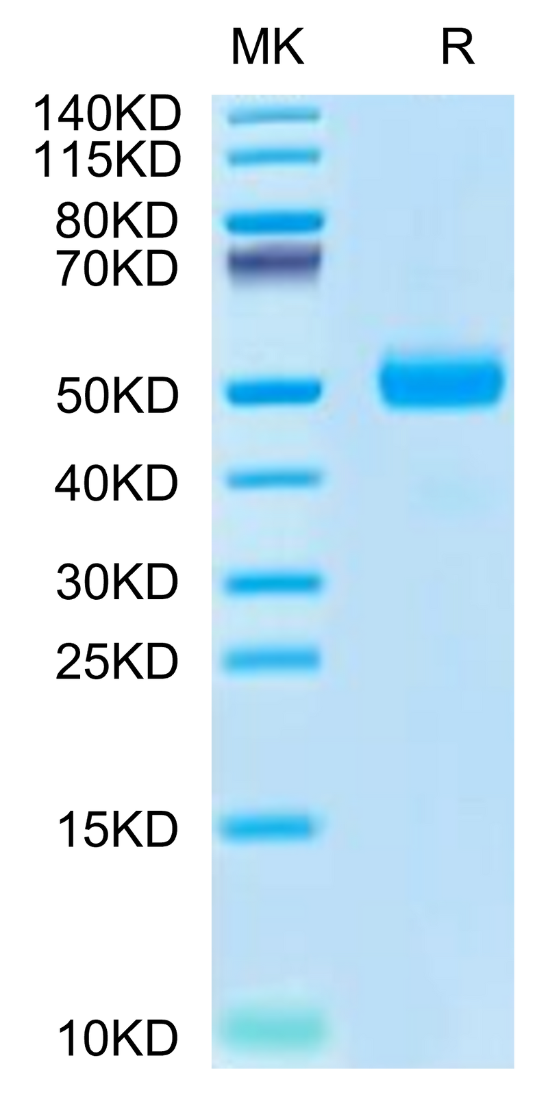 Cynomolgus SPP1 on Tris-Bis PAGE under reduced condition. The purity is greater than 95%.Recombinant Cynomolgus SPP1/OPN Protein