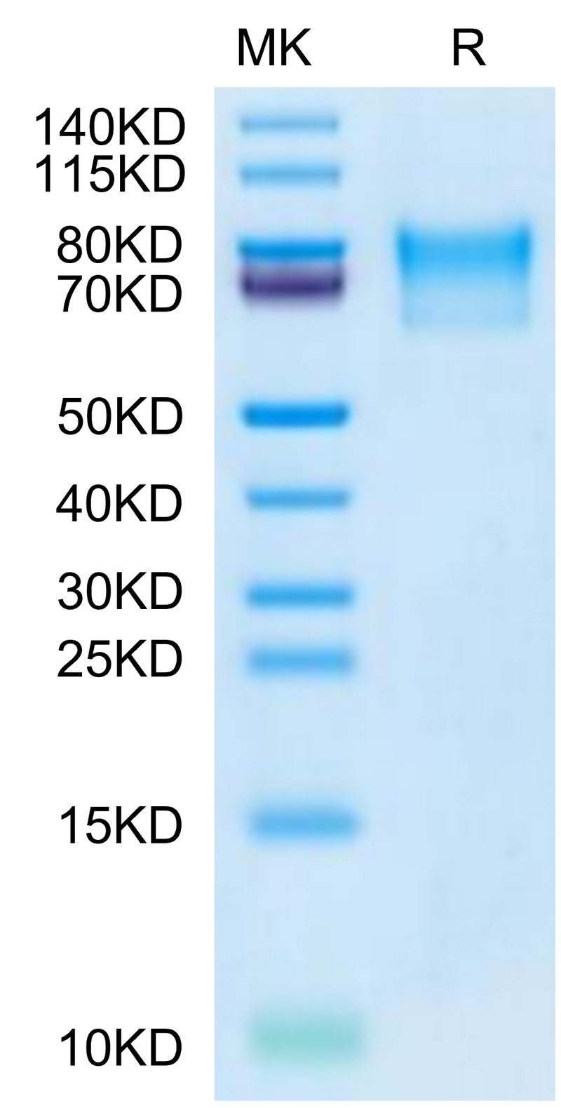 Varicella-zoster virus (strain Oka vaccine) Envelope glycoprotein E on Tris-Bis PAGE under reduced condition. The purity is greater than 95%.Recombinant Varicella-zoster virus (strain Oka vaccine) Envelope glycoprotein E Protein