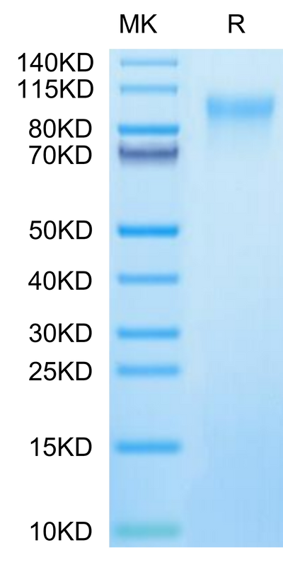 HRSV (A, strain Long) Glycoprotein G on Tris-Bis PAGE under reduced condition. The purity is greater than 95%.Recombinant HRSV (A, strain Long) Glycoprotein G Protein
