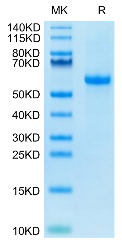 Biotinylated Human Notch 3 on Tris-Bis PAGE under reduced condition. The purity is greater than 95%.Biotinylated Human Notch 3 Protein