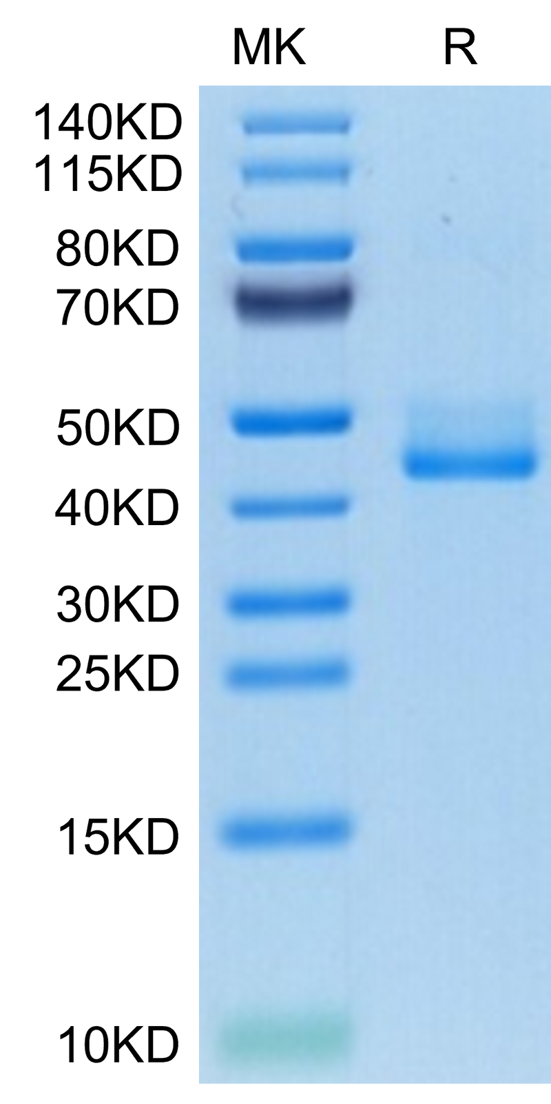 Human BAFFR on Tris-Bis PAGE under reduced condition. The purity is greater than 95%.Recombinant Human BAFFR/TNFRSF13C Protein, Active