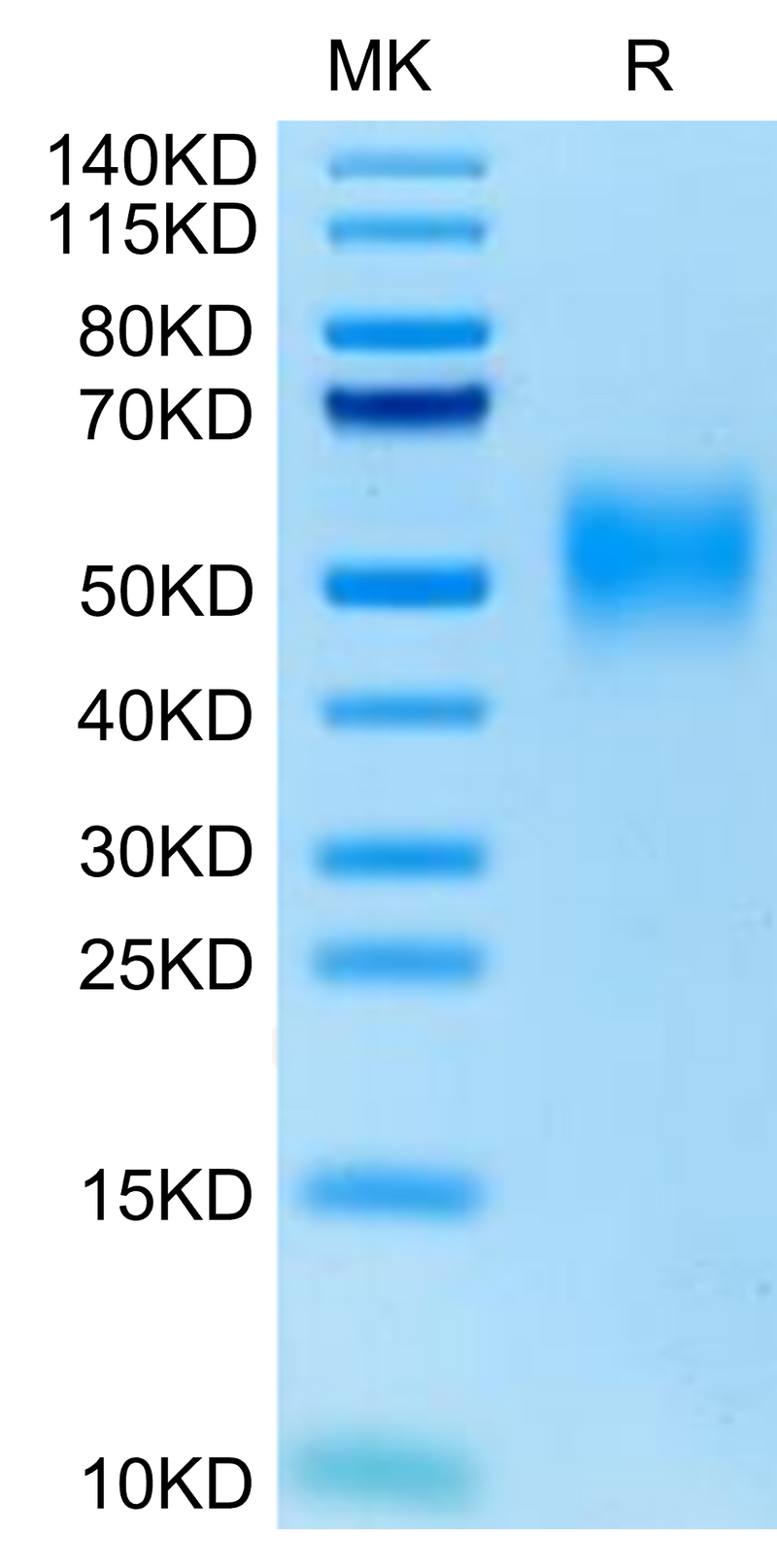 Cynomolgus/Rhesus macaque CD47 on Tris-Bis PAGE under reduced condition. The purity is greater than 95%.Recombinant Cynomolgus/Rhesus macaque CD47 Protein, Active