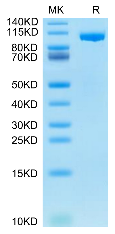 Mouse ENPP-1 on Tris-Bis PAGE under reduced condition. The purity is greater than 95%.Recombinant Mouse ENPP-1 Protein
