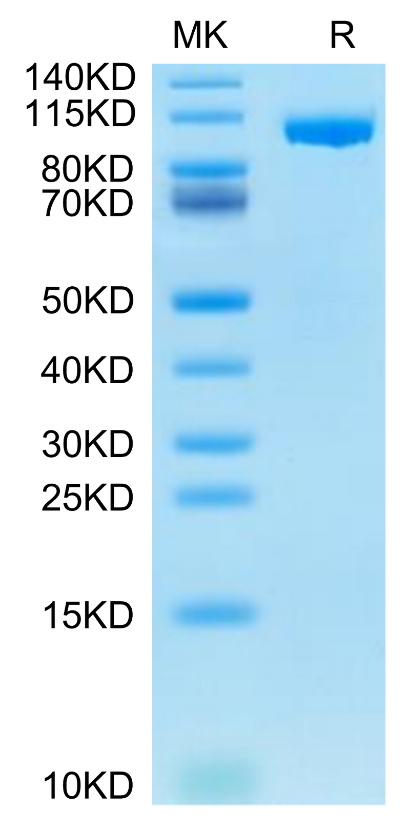 Mouse ENPP-1 on Tris-Bis PAGE under reduced condition. The purity is greater than 95%.Recombinant Mouse ENPP-1 Protein