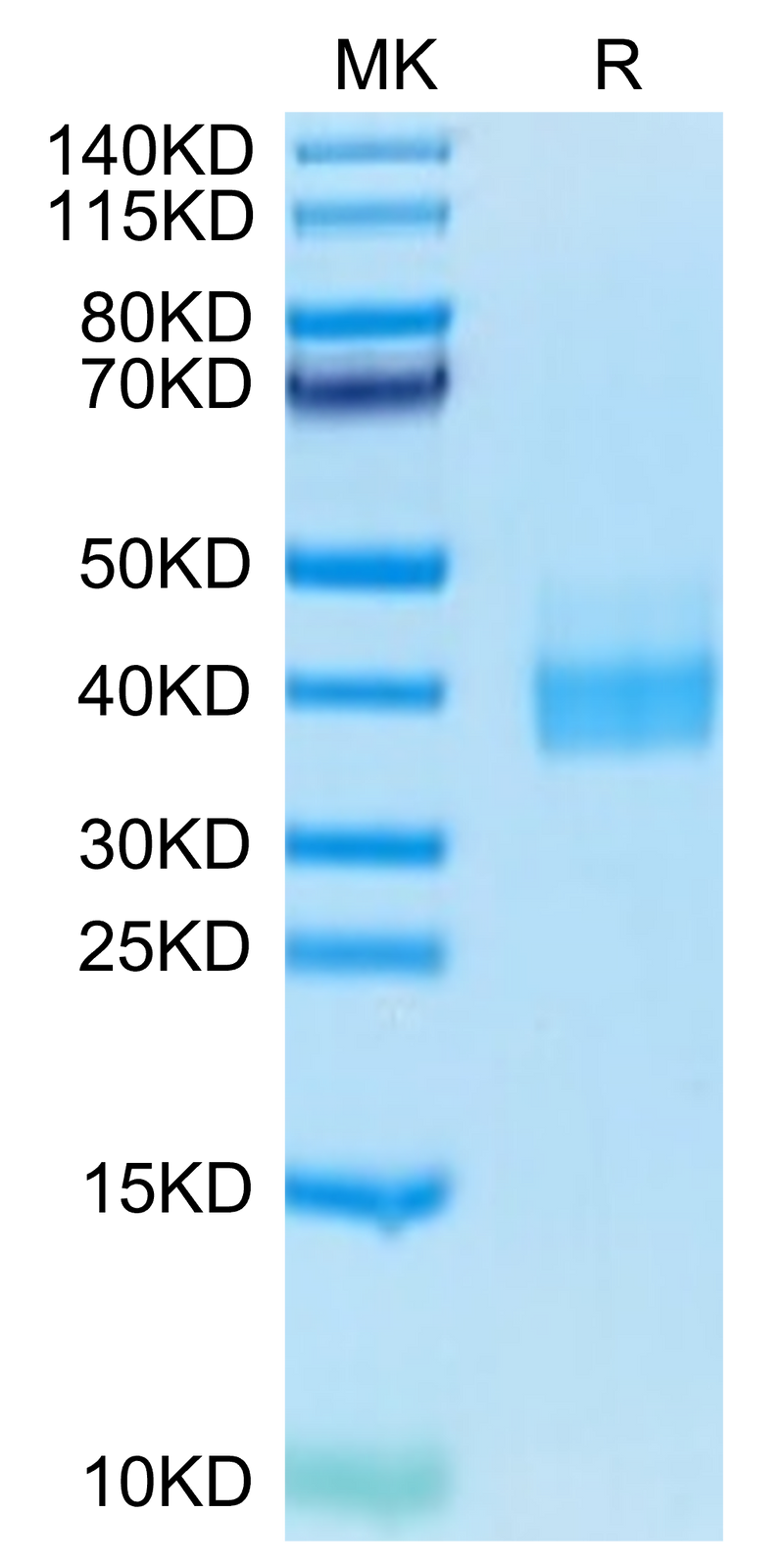 Biotinylated Human PD-L1 on Tris-Bis PAGE under reduced condition. The purity is greater than 95%.Biotinylated Human PD-L1/B7-H1 Protein, Active