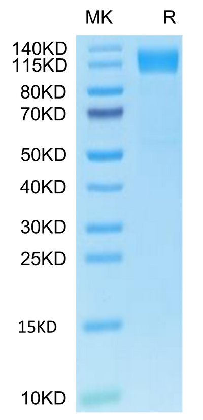 Human OSMR&GP130 on Tris-Bis PAGE under reduced condition. The purity is greater than 95%.Recombinant Human OSMR&GP130 Protein, Active