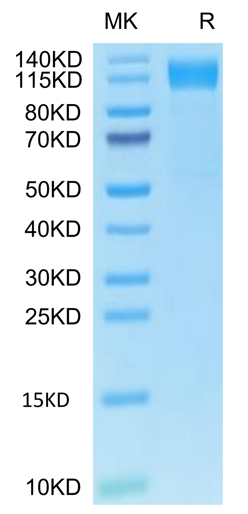 Human OSMR&GP130 on Tris-Bis PAGE under reduced condition. The purity is greater than 95%.Recombinant Human OSMR&GP130 Protein, Active