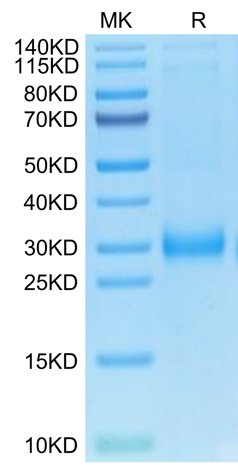 Cynomolgus TRAIL R2 on Tris-Bis PAGE under reduced condition. The purity is greater than 95%.Recombinant Cynomolgus TRAIL R2/DR5/TNFRSF10B Protein, Active