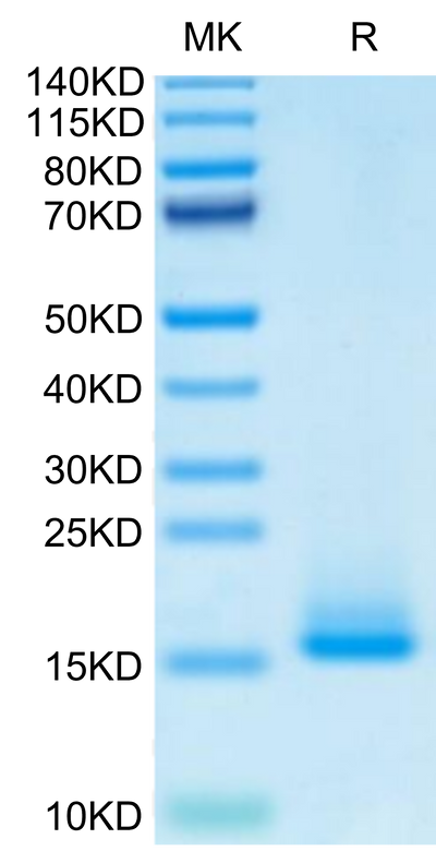 Monkeypox virus A35R on Tris-Bis PAGE under reduced condition. The purity is greater than 95%.Recombinant Monkeypox virus A35R Protein