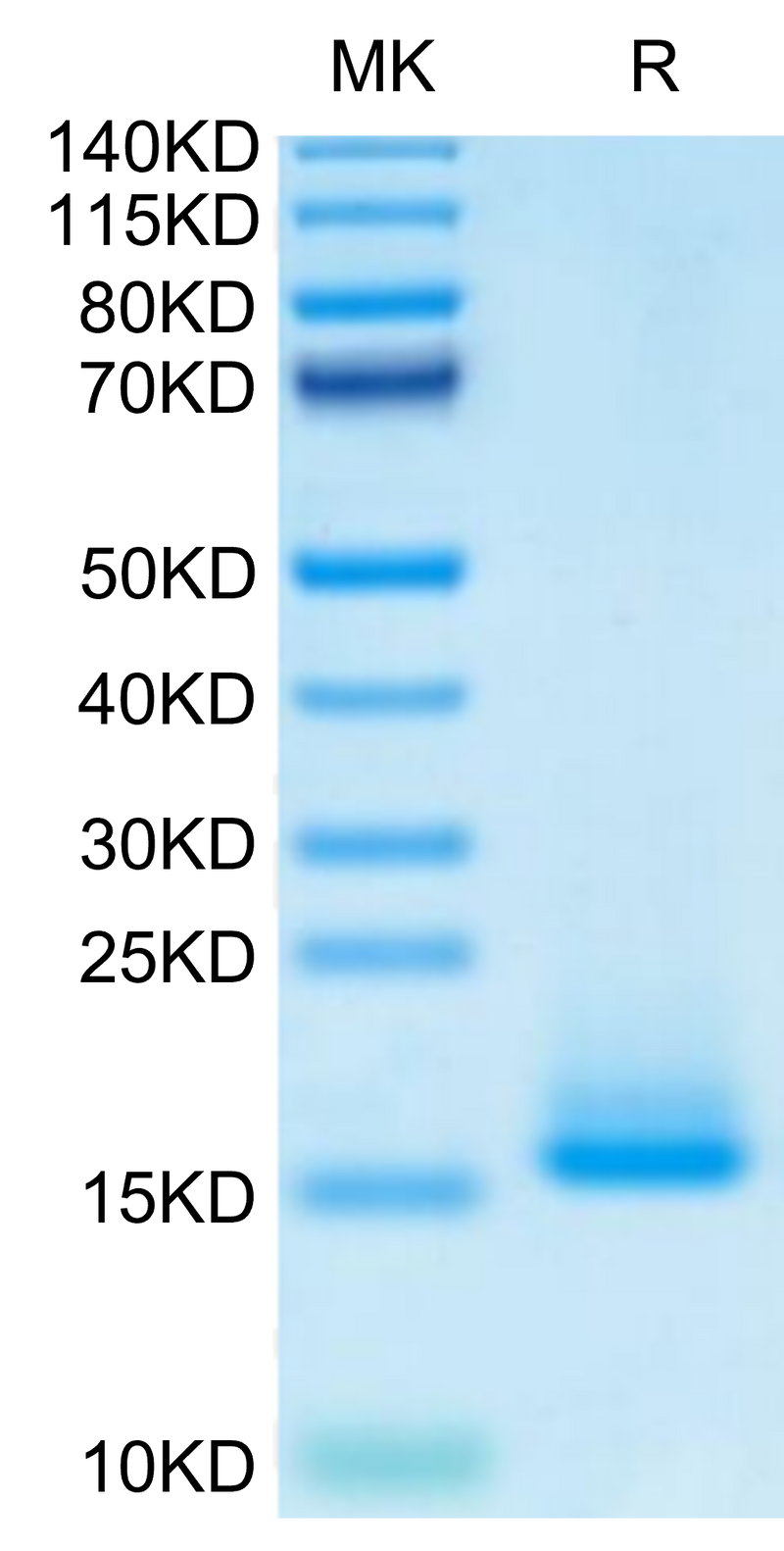Monkeypox virus A35R on Tris-Bis PAGE under reduced condition. The purity is greater than 95%.Recombinant Monkeypox virus A35R Protein