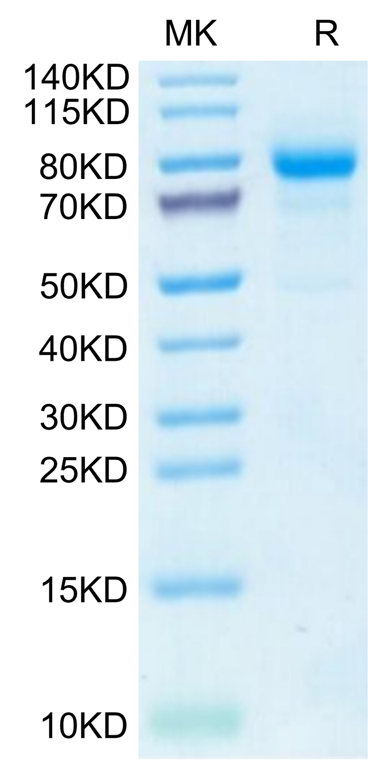 Human CDH6 on Tris-Bis PAGE under reduced condition. The purity is greater than 95%.Recombinant Human CDH6/Cadherin-6 Protein, Active
