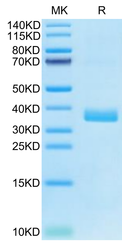 Human APOE4 on Tris-Bis PAGE under reduced condition. The purity is greater than 95%.Recombinant Human APOE4/Apolipoprotein E Protein