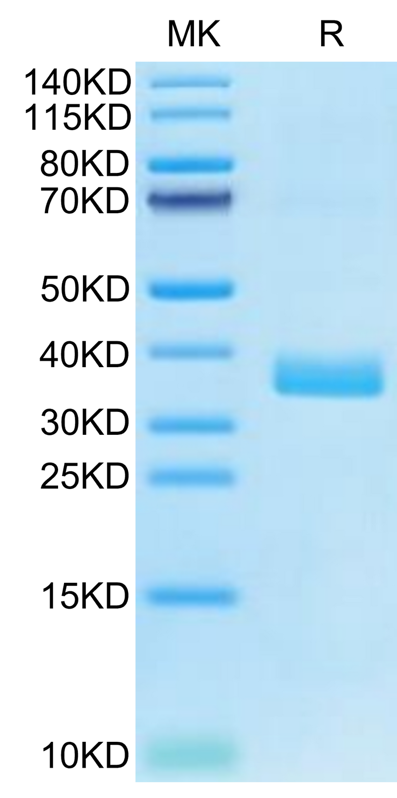 Human APOE4 on Tris-Bis PAGE under reduced condition. The purity is greater than 95%.Recombinant Human APOE4/Apolipoprotein E Protein