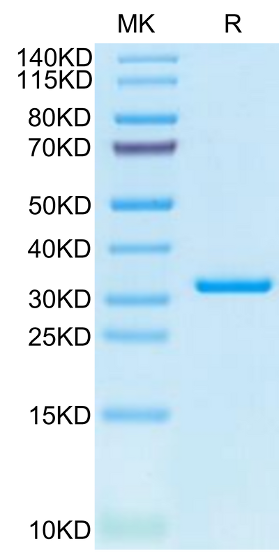 SARS-CoV-2 3CLpro (L50F, E166V) on Tris-Bis PAGE under reduced condition. The purity is greater than 95%.Recombinant SARS-CoV-2 3CLpro/3C-like Protease Protein (L50F, E166V)