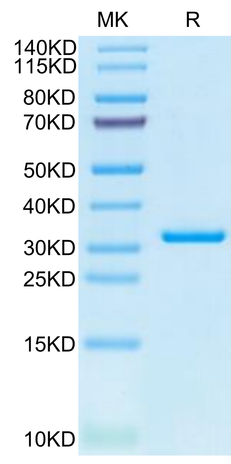 SARS-CoV-2 3CLpro (L50F, E166V) on Tris-Bis PAGE under reduced condition. The purity is greater than 95%.Recombinant SARS-CoV-2 3CLpro/3C-like Protease Protein (L50F, E166V)