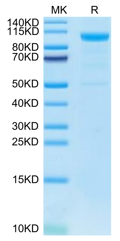 Human MASP3 on Tris-Bis PAGE under reduced condition. The purity is greater than 95%.Recombinant Human MASP3 Protein