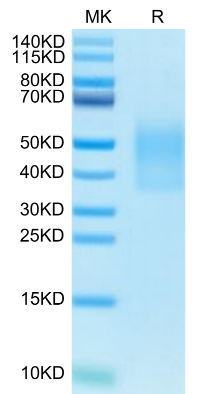 Cynomolgus IL-18BP on Tris-Bis PAGE under reduced condition. The purity is greater than 95%.Recombinant Cynomolgus IL-18BP Protein, Active