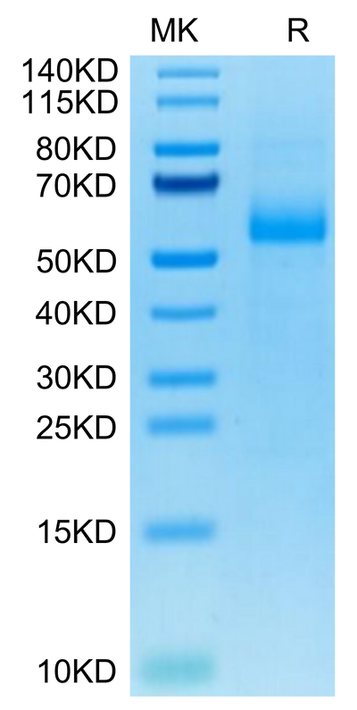 Cynomolgus AGER on Tris-Bis PAGE under reduced condition. The purity is greater than 95%.Recombinant Cynomolgus AGER Protein
