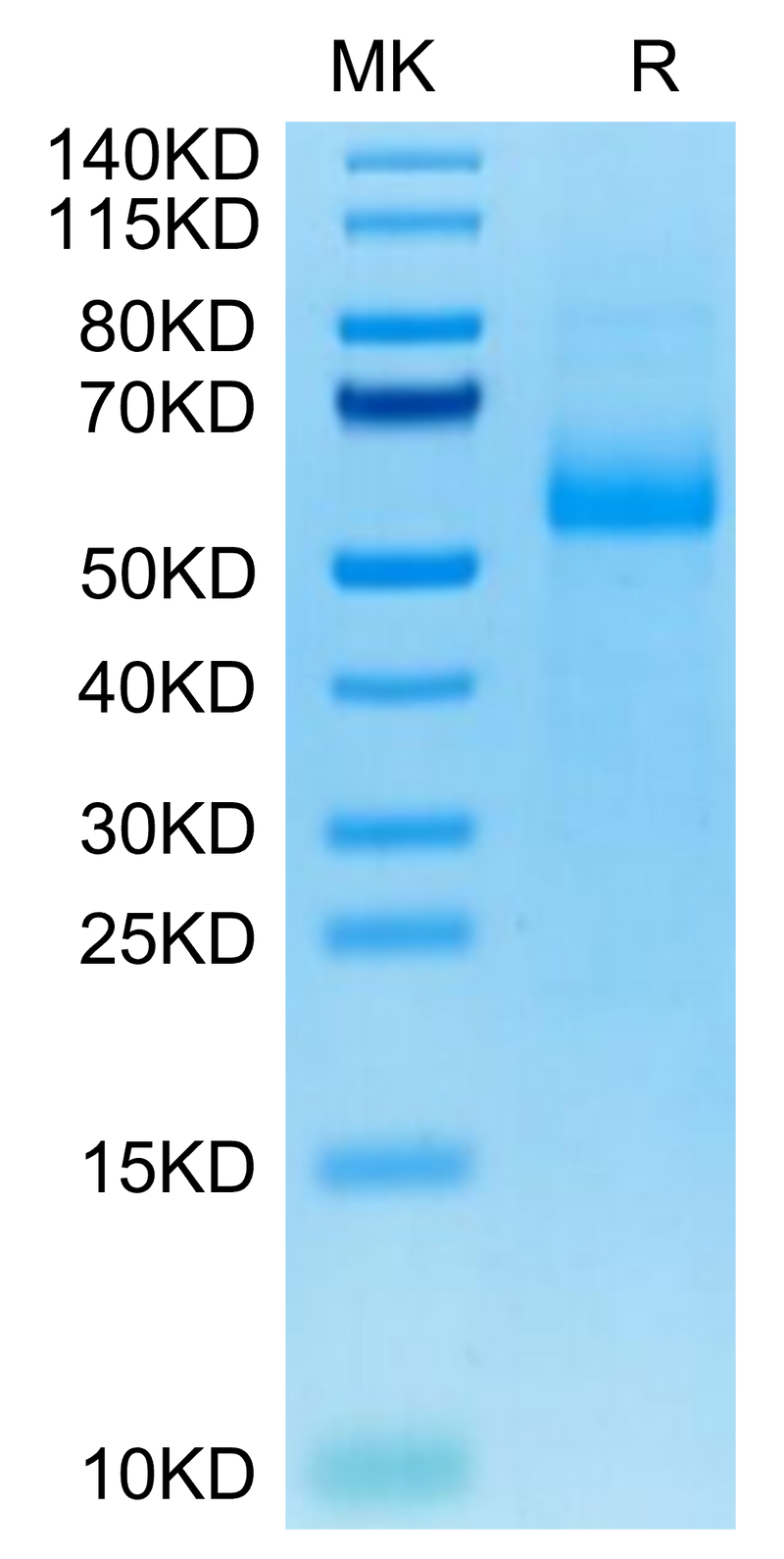 Cynomolgus AGER on Tris-Bis PAGE under reduced condition. The purity is greater than 95%.Recombinant Cynomolgus AGER Protein