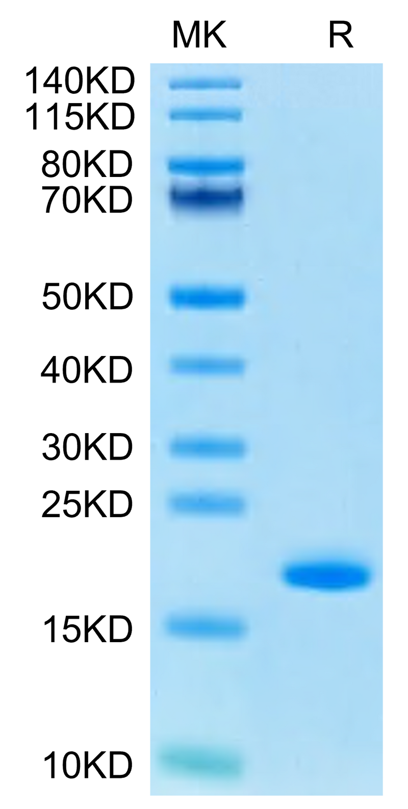 Human FGF basic (154aa) on Tris-Bis PAGE under reduced condition. The purity is greater than 95%.Recombinant Human FGF basic (154aa) Protein, Active