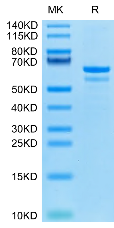 Human Tubby on Tris-Bis PAGE under reduced condition. The purity is greater than 95%.Recombinant Human Tubby Protein