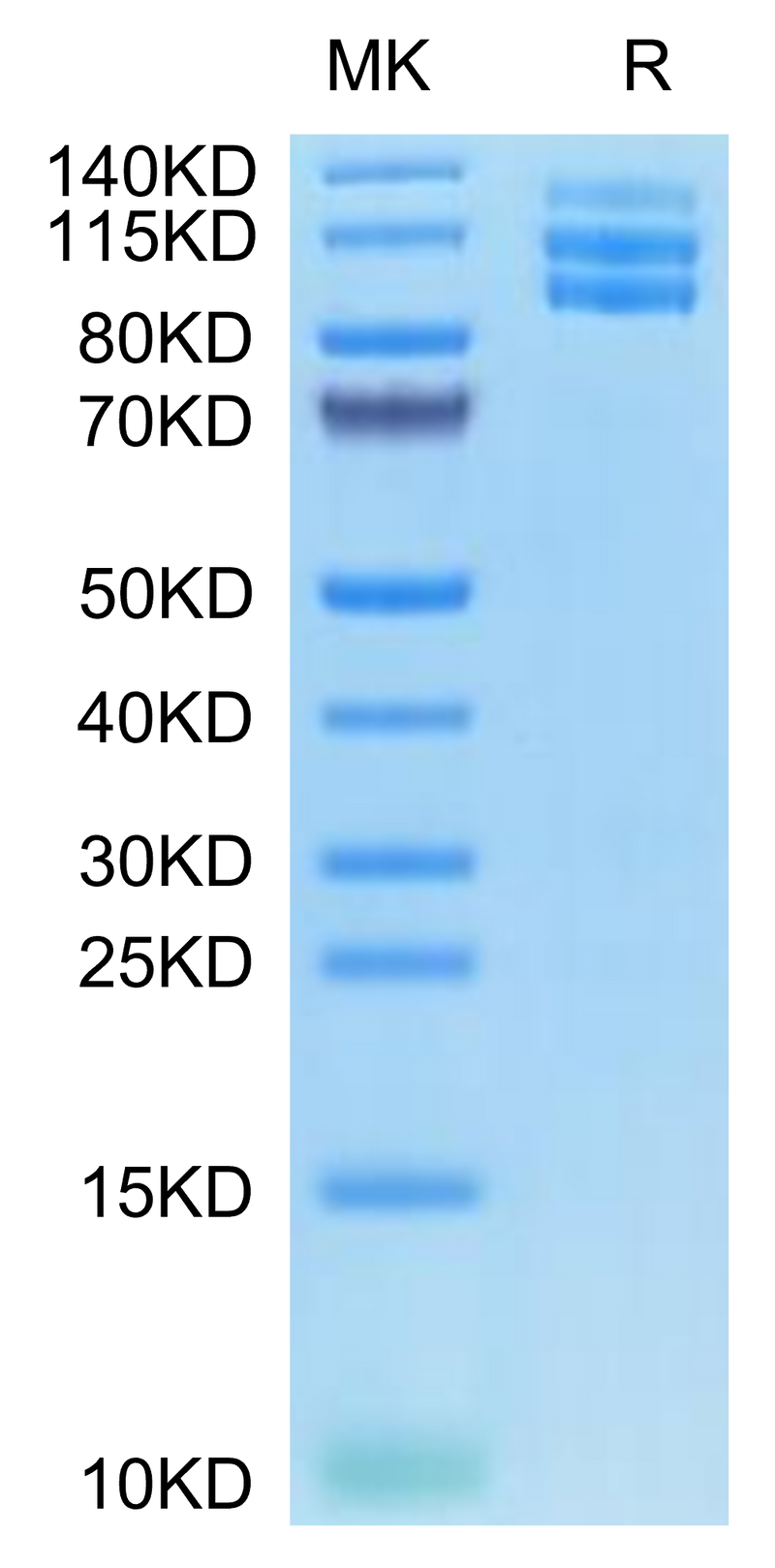 Biotinylated Mouse ITGAV&ITGB3 on Tris-Bis PAGE under reduced condition. The purity is greater than 95%.Biotinylated Mouse Integrin alpha V beta 3 (ITGAV&ITGB3) Heterodimer Protein, Active