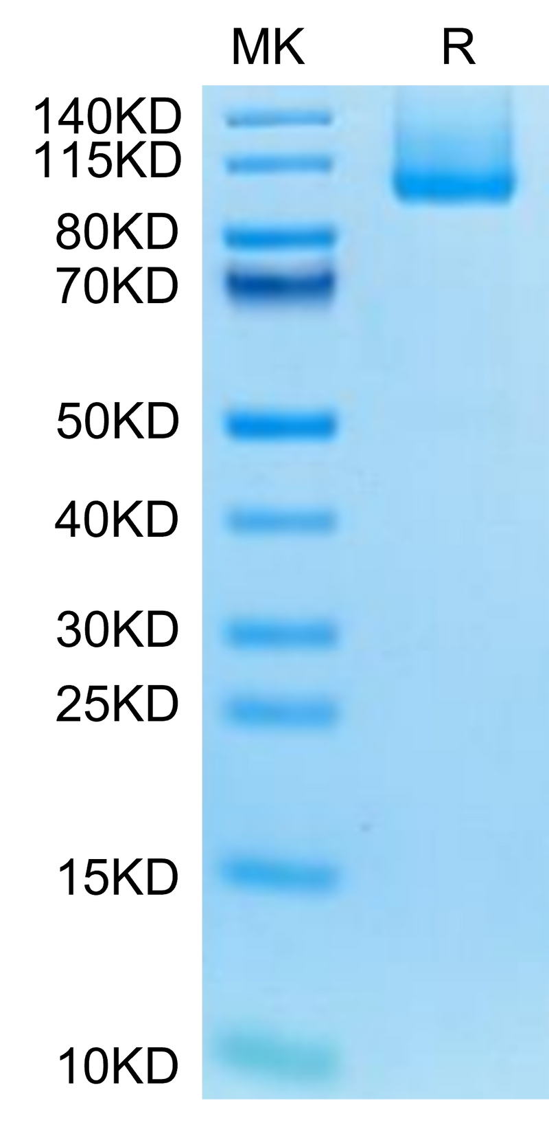 Biotinylated Mouse CDH17 on Tris-Bis PAGE under reduced condition. The purity is greater than 95%.Biotinylated Mouse CDH17/Cadherin 17 Protein (Primary Amine Labeling)