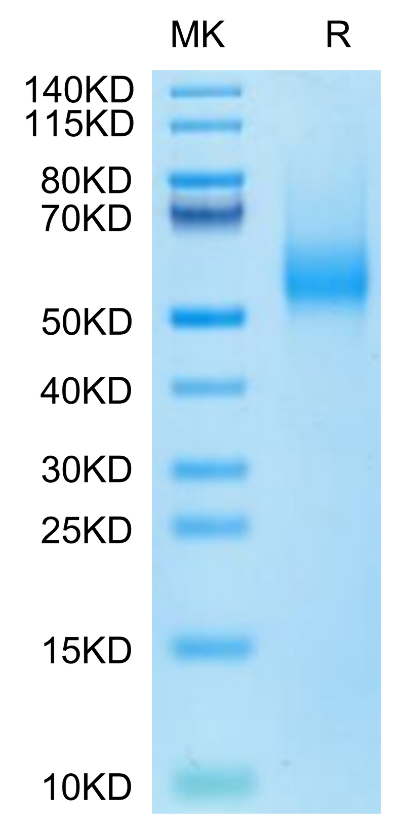 Biotinylated Human CDH17 on Tris-Bis PAGE under reduced condition. The purity is greater than 95%.Biotinylated Human CDH17/Cadherin 17 Domain 5-7 Protein (Primary Amine Labeling)