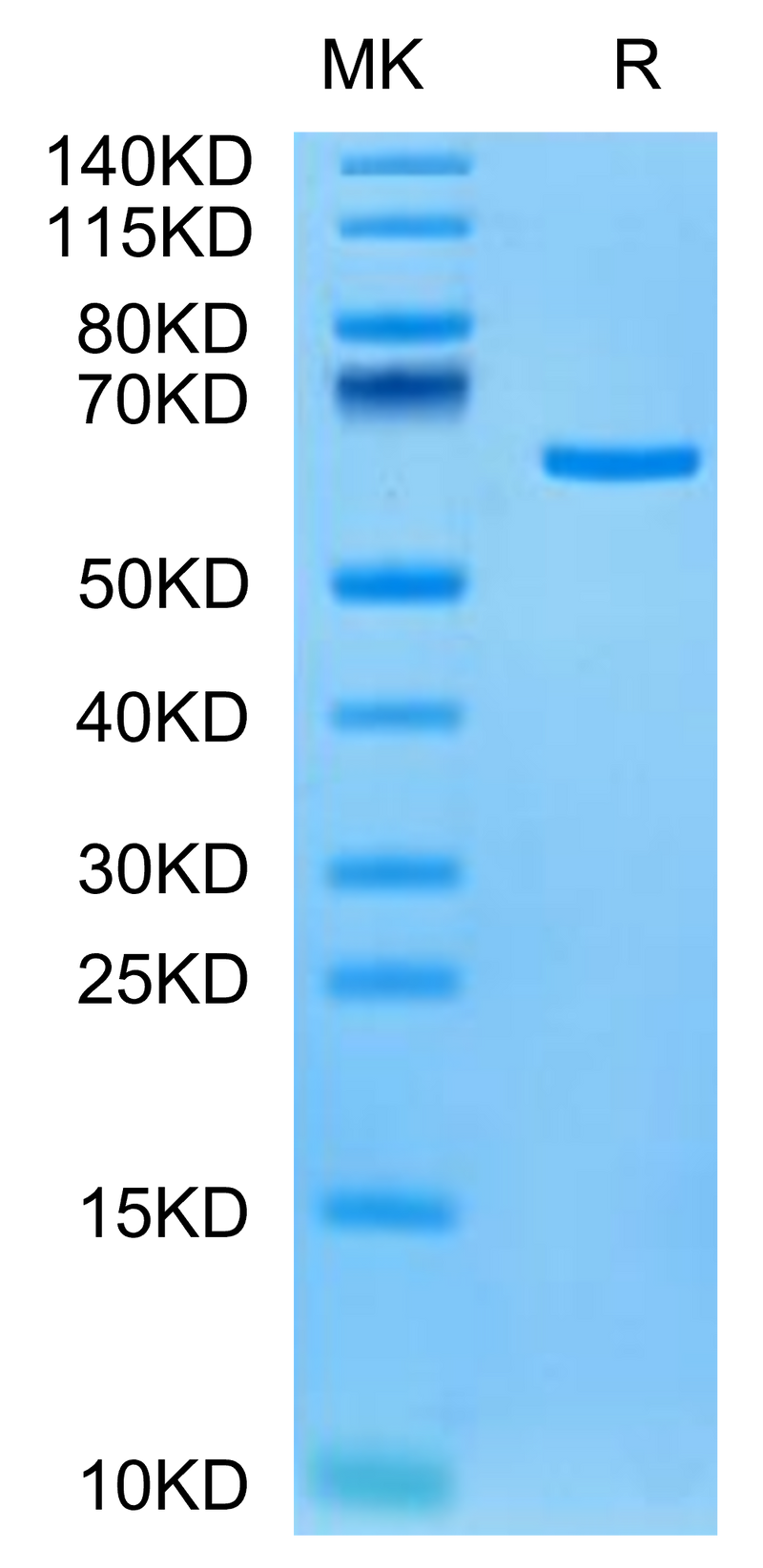 Human Tulp1 on Tris-Bis PAGE under reduced condition. The purity is greater than 95%.Recombinant Human Tulp1 Protein
