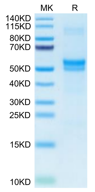 Human PDGFD on Tris-Bis PAGE under reduced condition. The purity is greater than 95%.Recombinant Human PDGFD Protein