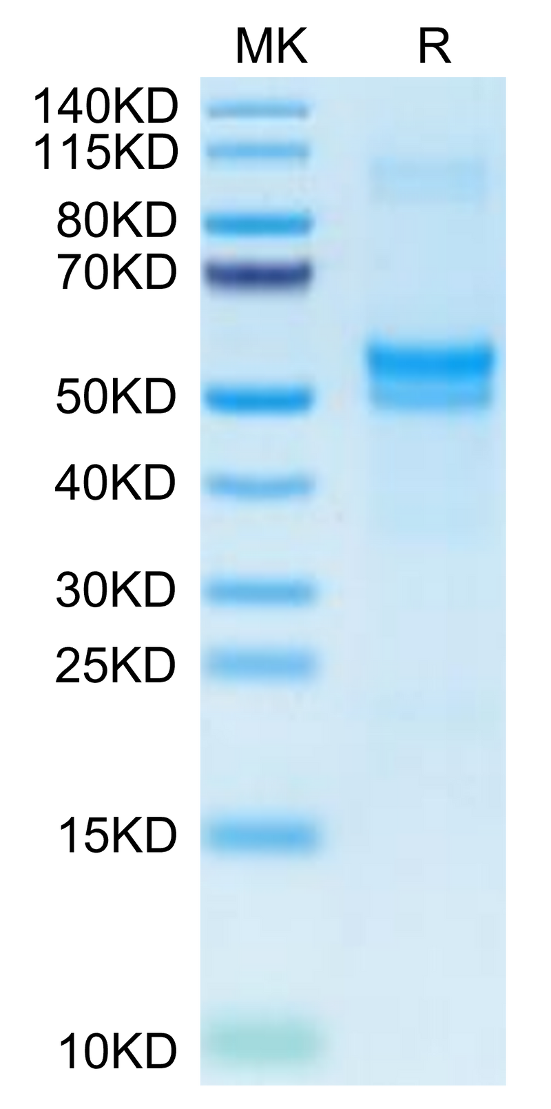 Human PDGFD on Tris-Bis PAGE under reduced condition. The purity is greater than 95%.Recombinant Human PDGFD Protein