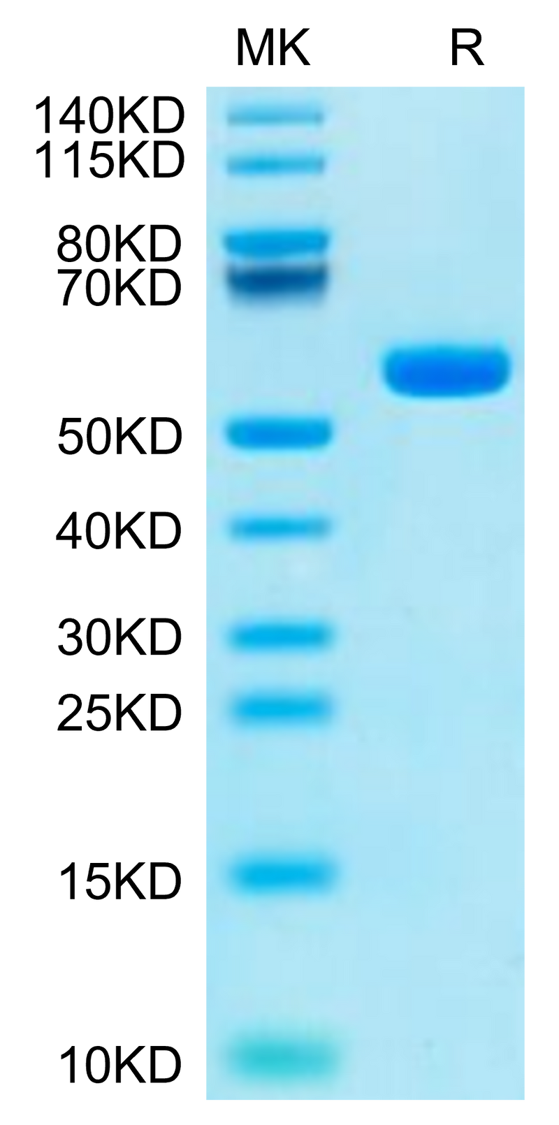 Human HLA-A*11:01&B2M&KRAS G12C (VVVGACGVGK) Monomer on Tris-Bis PAGE under reduced condition. The purity is greater than 95%.Recombinant Human HLA-A*11:01&B2M&KRAS G12C (VVVGACGVGK) Monomer Protein