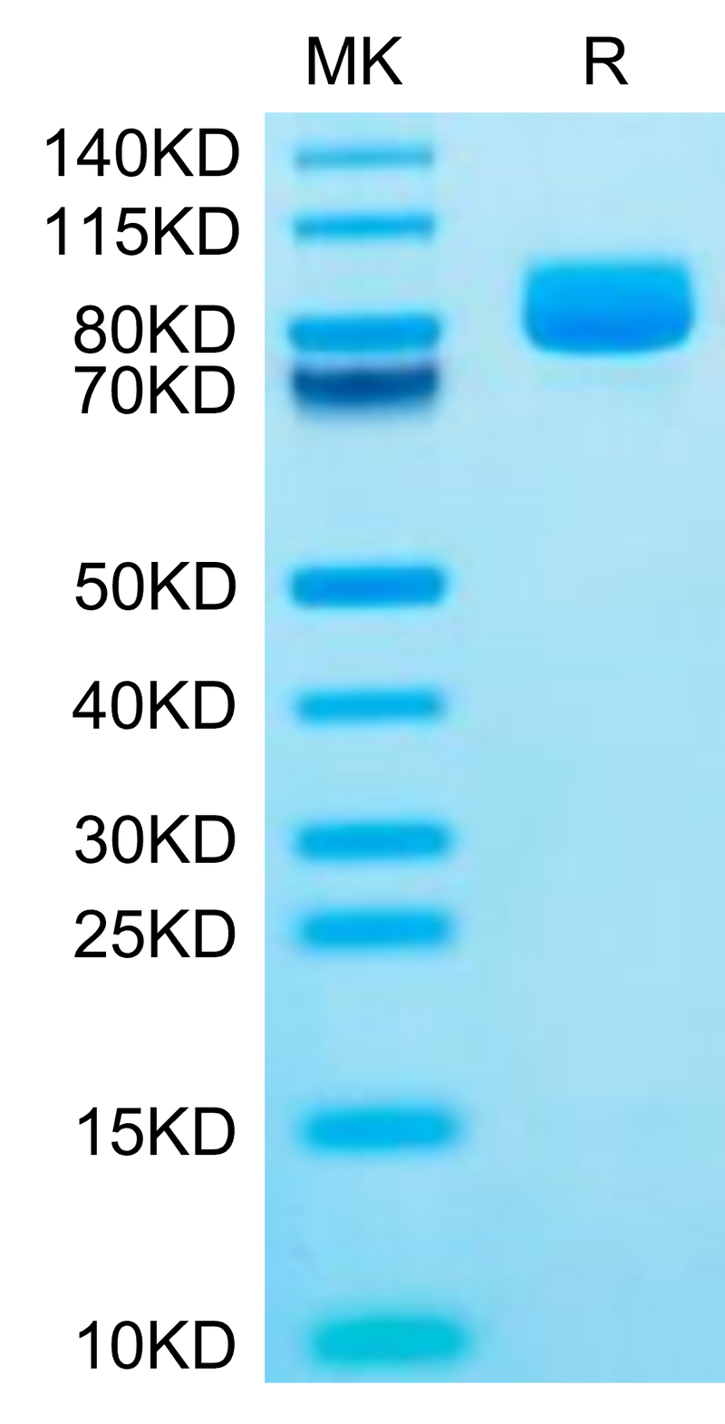 Mouse XPNPEP2 on Tris-Bis PAGE under reduced condition. The purity is greater than 95%.Recombinant Mouse XPNPEP2 Protein