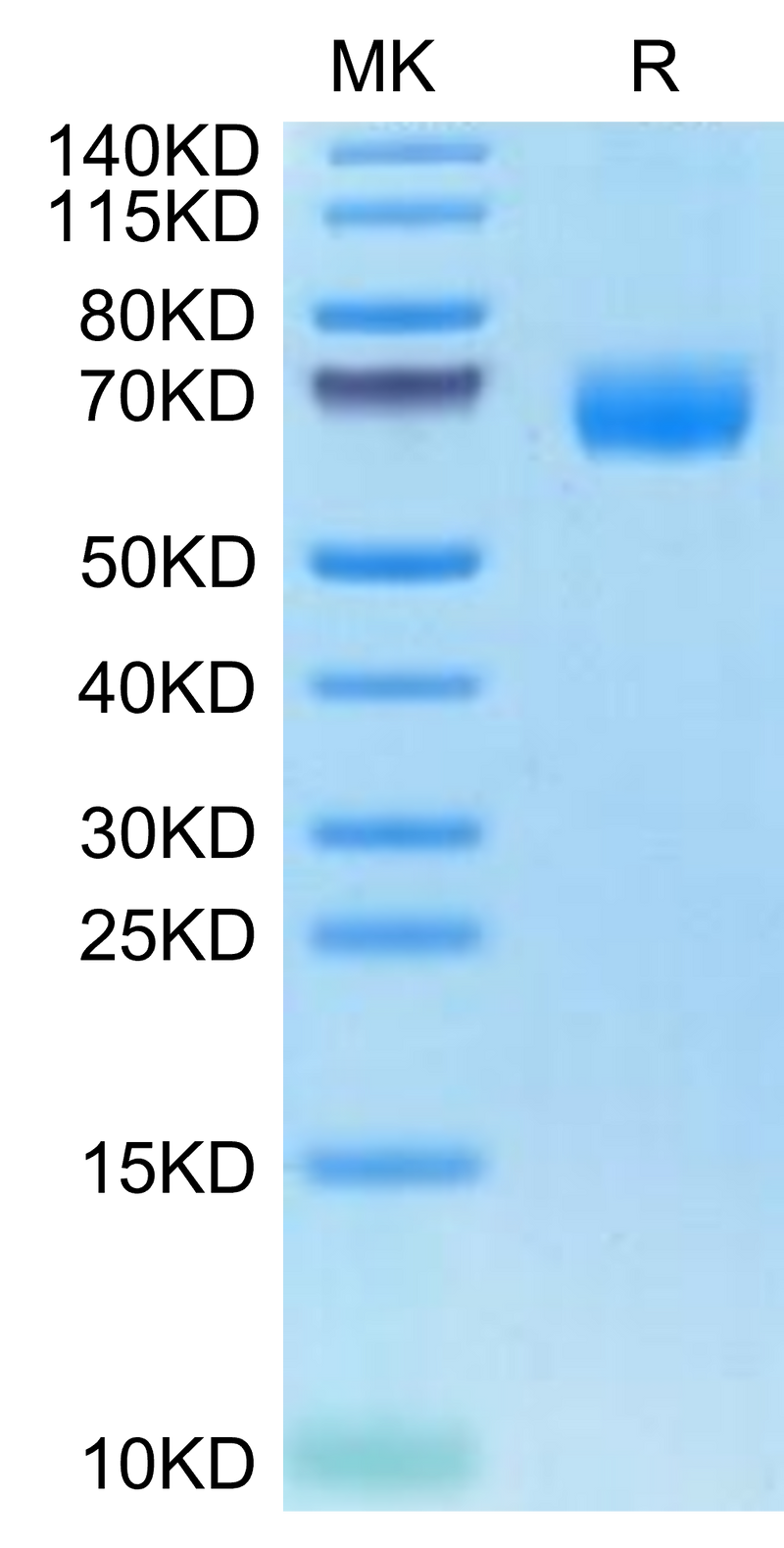 Cynomolgus ANGPTL3 on Tris-Bis PAGE under reduced condition. The purity is greater than 95%.Recombinant Cynomolgus ANGPTL3/Angiopoietin-like 3 Protein, Active