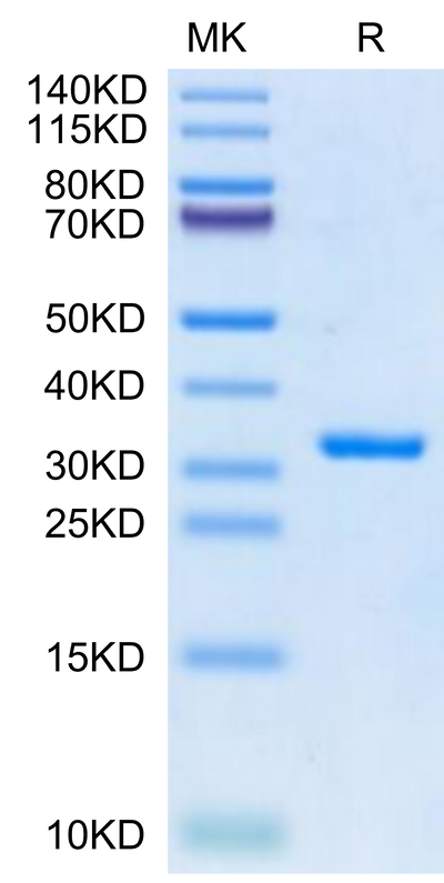 SARS-CoV-2 3CLpro (E166V) on Tris-Bis PAGE under reduced condition. The purity is greater than 95%.Recombinant SARS-CoV-2 3CLpro/3C-like Protease Protein (E166V)