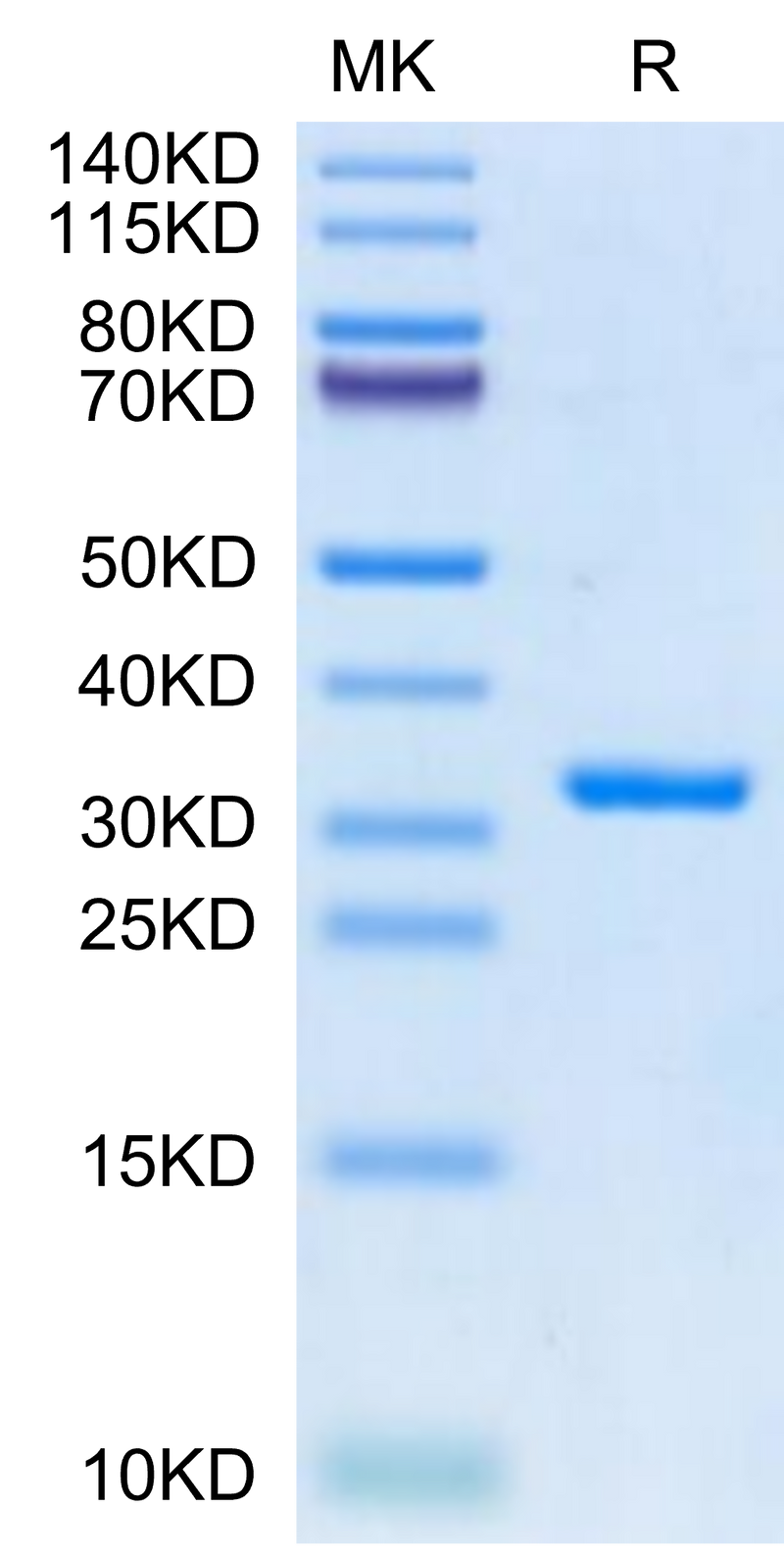 SARS-CoV-2 3CLpro (E166V) on Tris-Bis PAGE under reduced condition. The purity is greater than 95%.Recombinant SARS-CoV-2 3CLpro/3C-like Protease Protein (E166V)