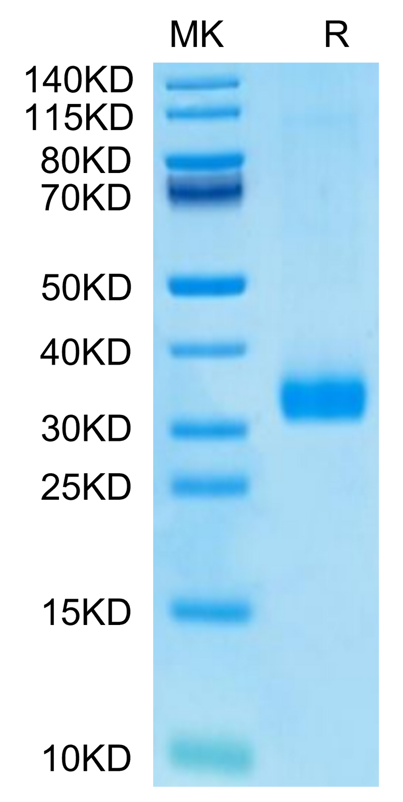 Human MBL2 on Tris-Bis PAGE under reduced condition. The purity is greater than 95%.Recombinant Human MBL2/Mannan Binding Lectin Protein