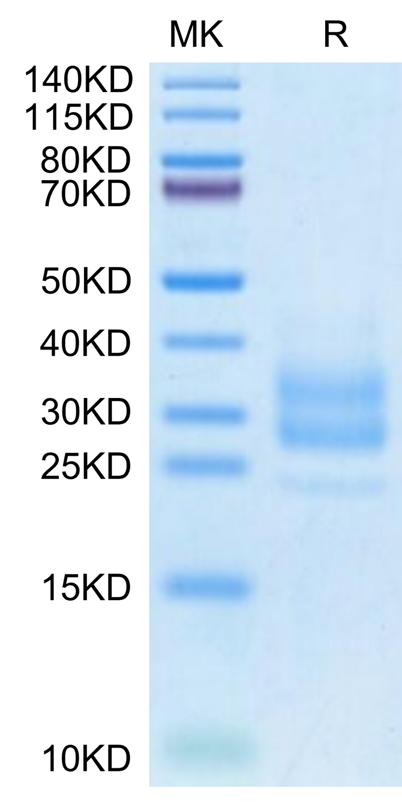 Monkeypox virus M1R on Tris-Bis PAGE under reduced condition. The purity is greater than 95%.Recombinant Monkeypox virus M1R Protein