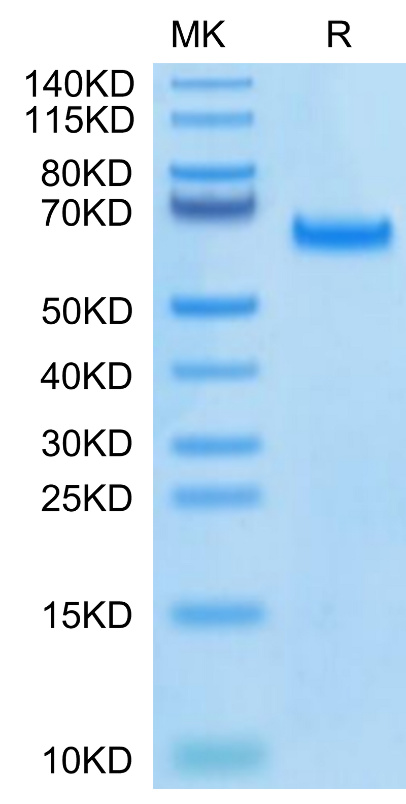 Biotinylated Human DLL4 on Tris-Bis PAGE under reduced condition. The purity is greater than 95%.Biotinylated Human DLL4 Protein, Active