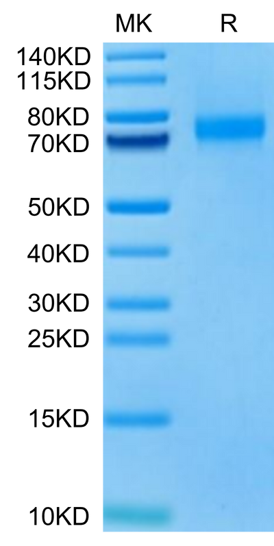 Biotinylated Human Siglec-10 (R119A) on Tris-Bis PAGE under reduced condition. The purity is greater than 95%.Biotinylated Human Siglec-10 (R119A) Protein, Active