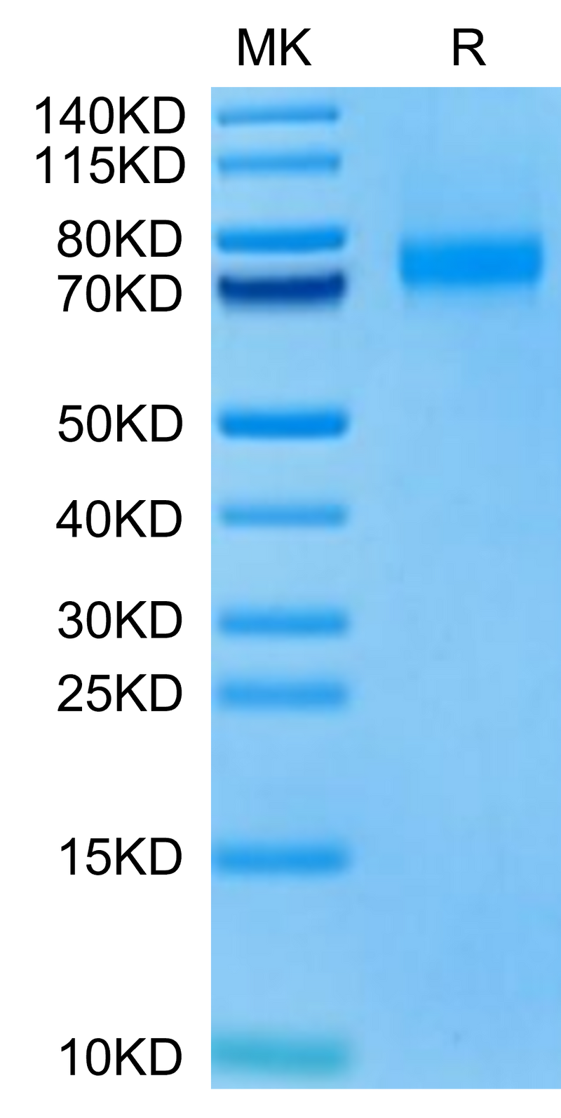 Biotinylated Human Siglec-10 (R119A) on Tris-Bis PAGE under reduced condition. The purity is greater than 95%.Biotinylated Human Siglec-10 (R119A) Protein, Active