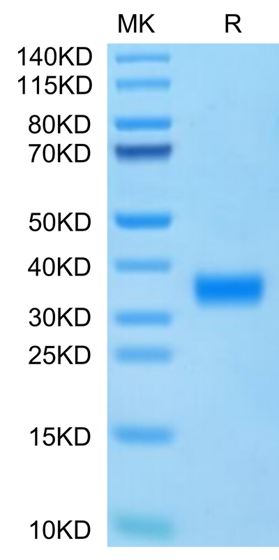 Cynomolgus Adiponectin on Tris-Bis PAGE under reduced condition. The purity is greater than 95%.Recombinant Cynomolgus Adiponectin/Acrp30 Protein