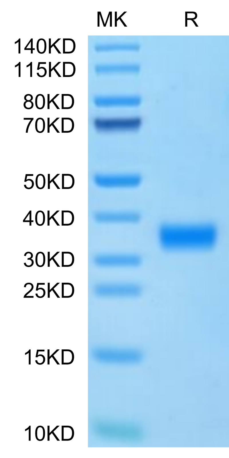Cynomolgus Adiponectin on Tris-Bis PAGE under reduced condition. The purity is greater than 95%.Recombinant Cynomolgus Adiponectin/Acrp30 Protein