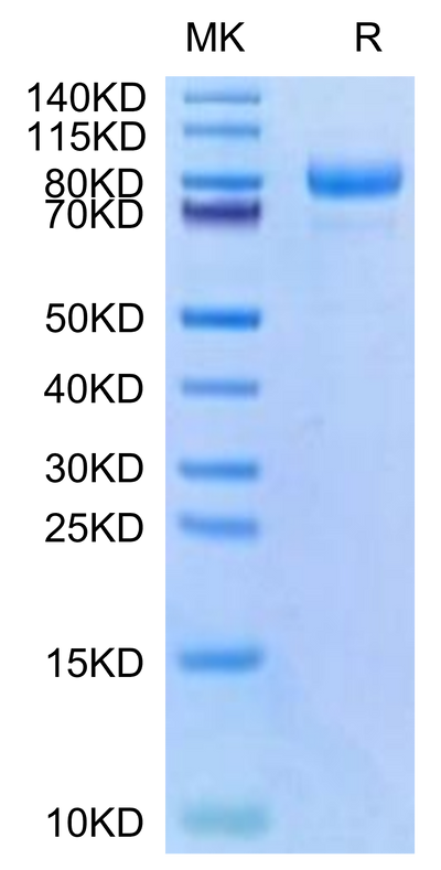 Cynomolgus CDH6 on Tris-Bis PAGE under reduced condition. The purity is greater than 95%.Recombinant Cynomolgus CDH6/Cadherin-6 Protein, Active