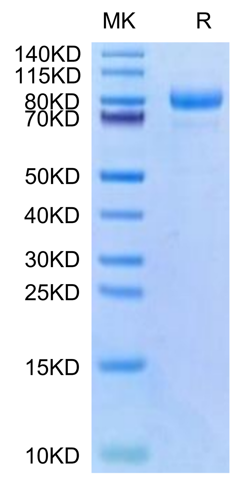 Cynomolgus CDH6 on Tris-Bis PAGE under reduced condition. The purity is greater than 95%.Recombinant Cynomolgus CDH6/Cadherin-6 Protein, Active