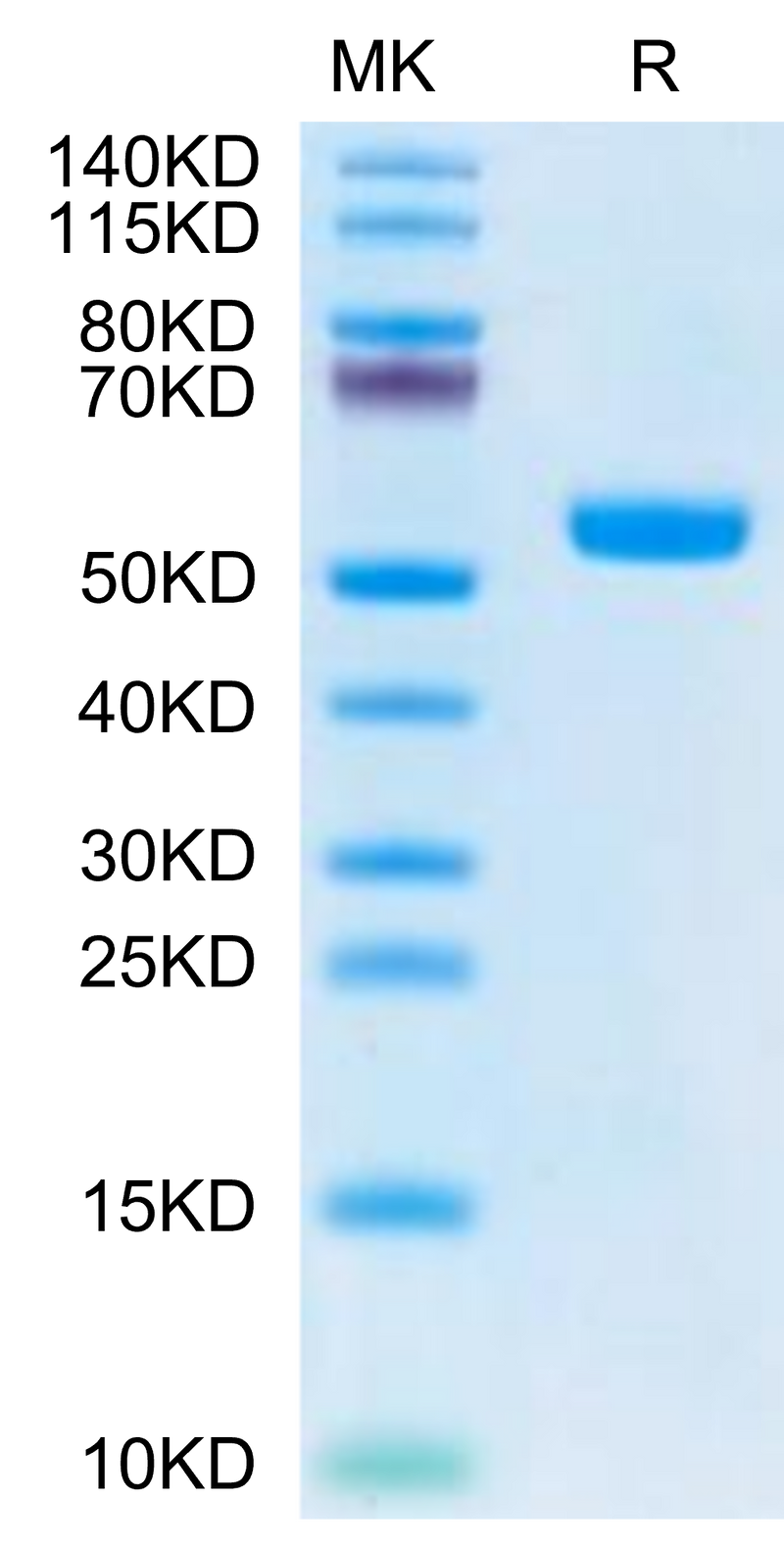 Biotinylated Human HLA-A*02:01&B2M&MAGE-A4 (KVLEHVVRV) Monomer on Tris-Bis PAGE under reduced condition. The purity is greater than 95%.Biotinylated Human HLA-A*02:01&B2M&MAGE-A4 (KVLEHVVRV) Monomer Protein